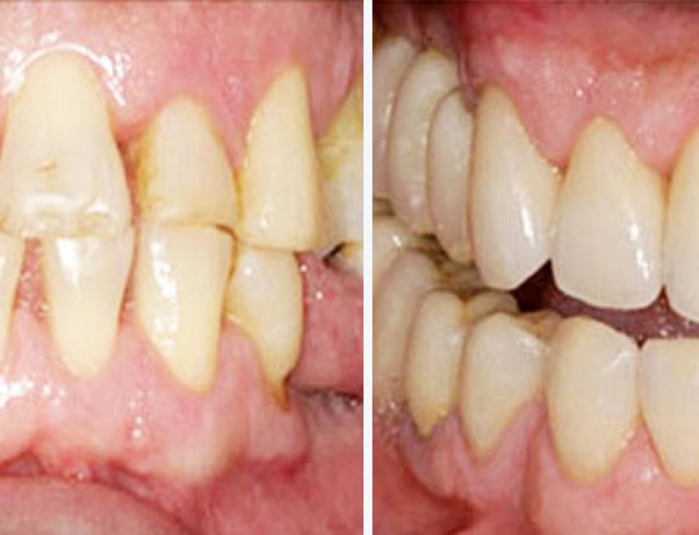 Tratamento de Dor Orofacial e Disfunção de ATM Dra. Fatima Faraco