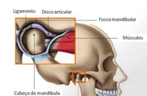 Tratamento da Disfunção da Articulação Temporomandibular (ATM) - Dra.  Fátima Faraco - Clínica Odontológica em Moema, SP