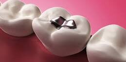 restauracao estetica dra fatima faraco 2