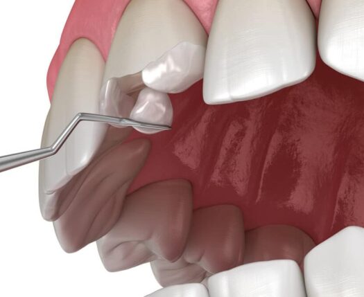 restauracao estetica dra fatima faraco