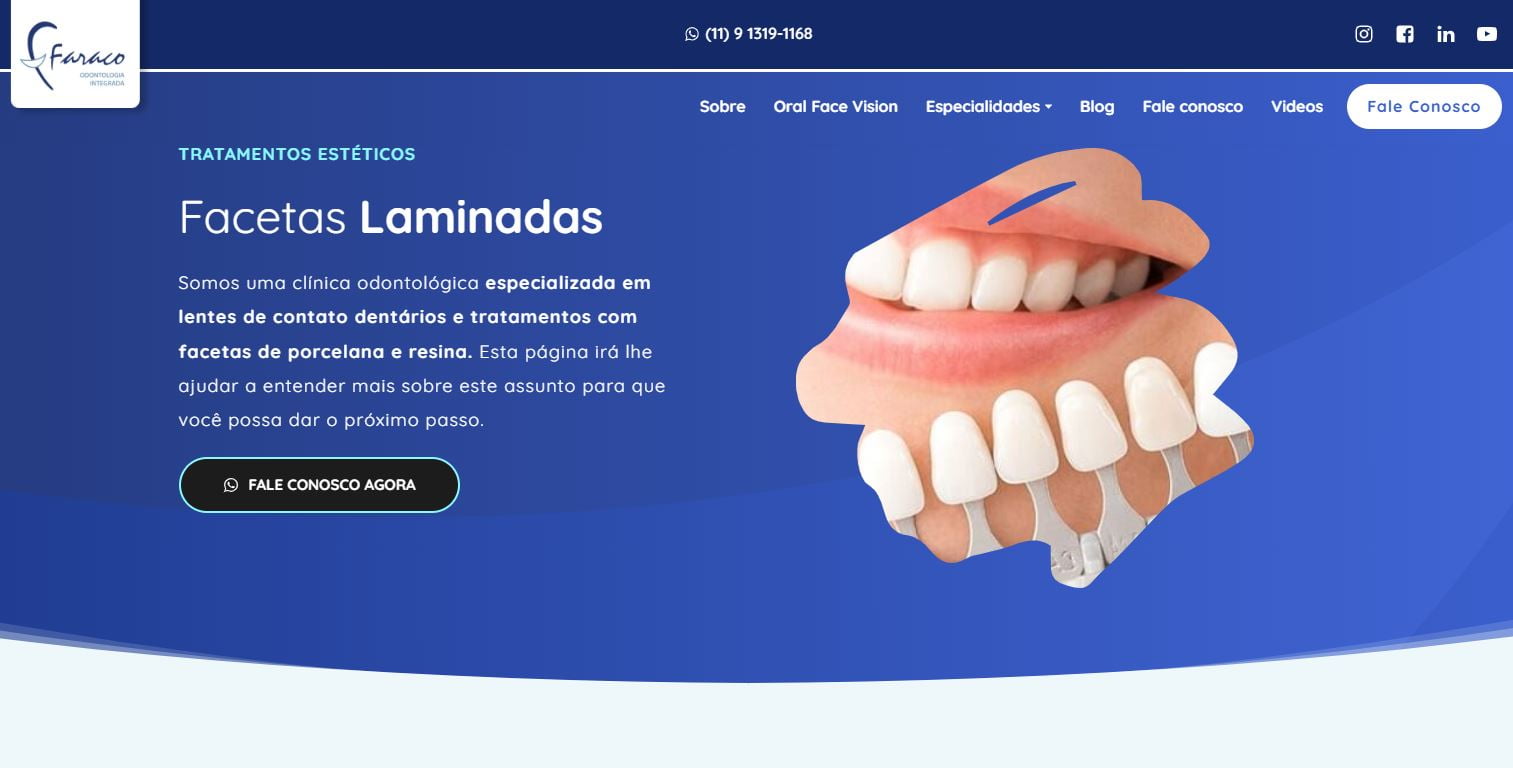 Reconstrução com Facetas - Dra. Fátima Faraco - Clínica Odontológica em  Moema, SP